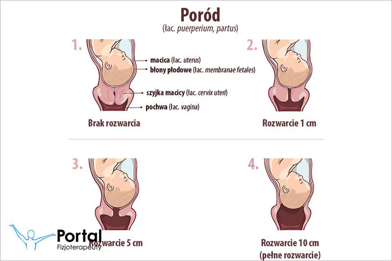 Czas skurczów po odejściu wód