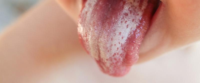 Profilaktyka pleśniawek u niemowląt