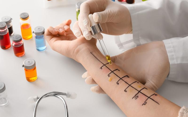 Przygotowanie dziecka do wizyty u alergologa