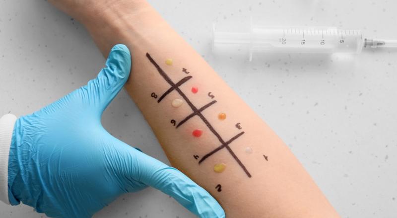 Testy alergiczne u dzieci