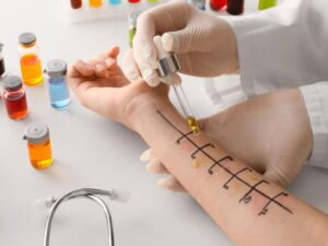 Jak wykonać testy alergiczne u dzieci – Poradnik dla rodziców