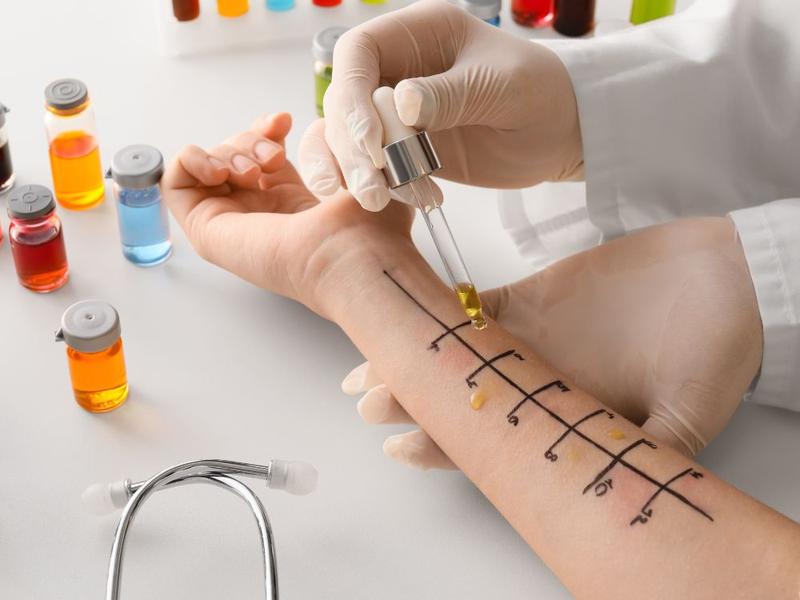 Jak wykonać testy alergiczne u dzieci – Poradnik dla rodziców