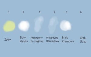 Śluz w ciąży – co warto wiedzieć i na co zwrócić uwagę?