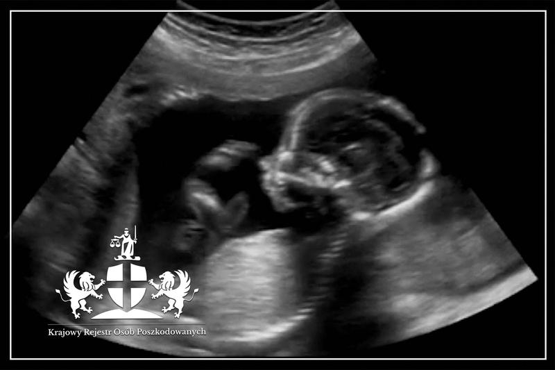 Etapy ciąży i badania USG