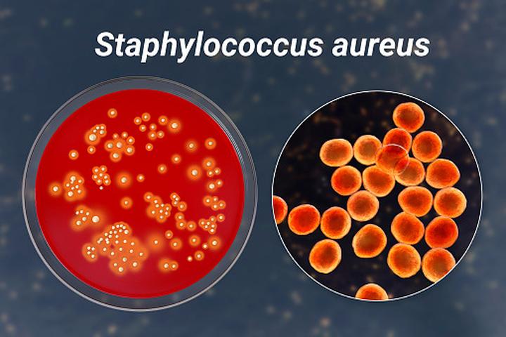 Gronkowiec a karmienie piersią