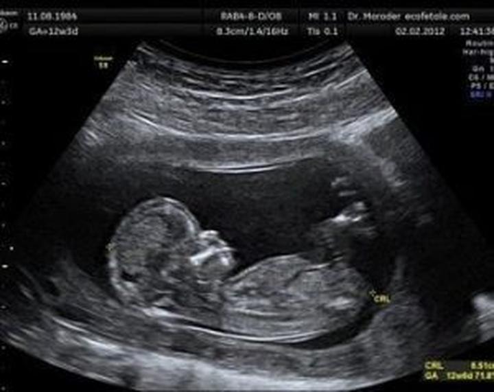 Harmonogram badań prenatalnych