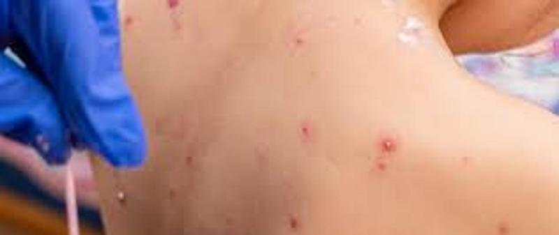 Karmienie piersią a odporność