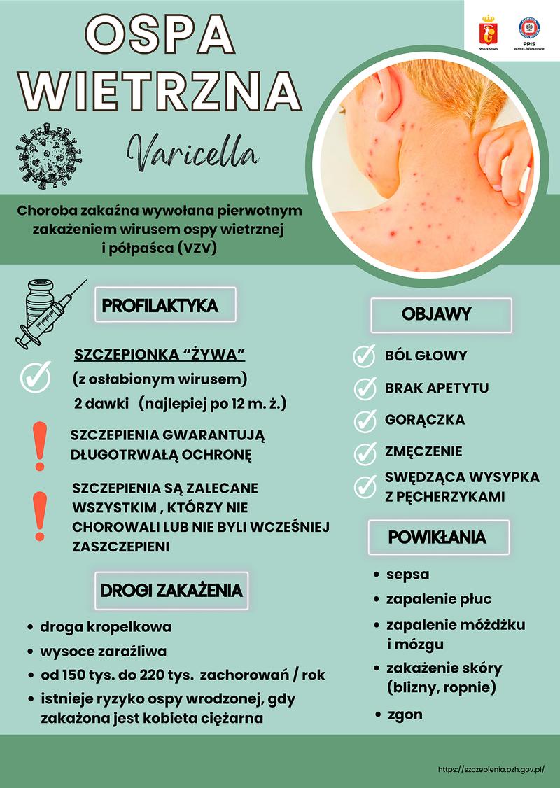 Objawy ospy wietrznej