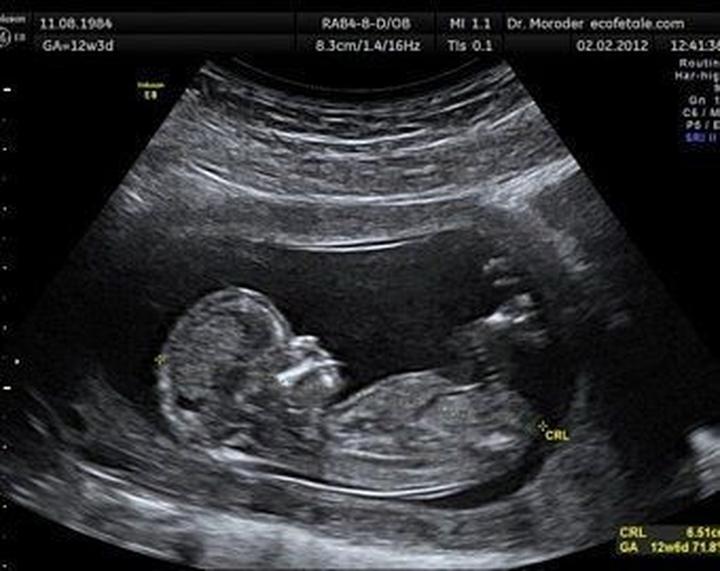 Przygotowanie do badania USG