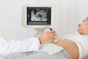 Jak często powinno się wykonywać USG w ciąży? Przewodnik dla przyszłych mam