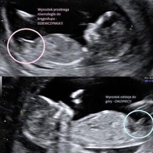 Jak wczesne oznaki pozwalają rozpoznać płeć dziecka na początku ciąży?