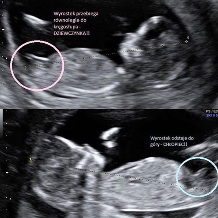 Jak wczesne oznaki pozwalają rozpoznać płeć dziecka na początku ciąży?