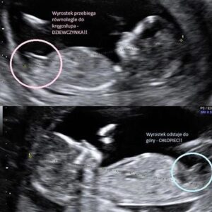 Kiedy fachowiec się myli: czy lekarz może pomylić płeć dziecka?