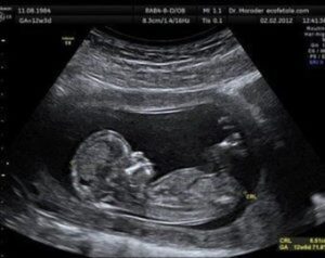 Przewodnik po USG ciąży: Jak sprawnie interpretować wyniki?