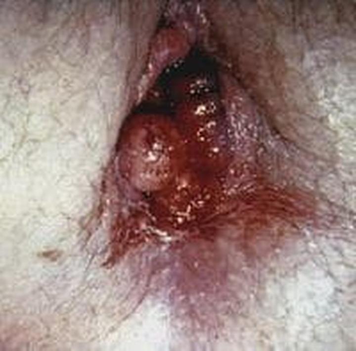 Dieta i aktywność fizyczna w połogu