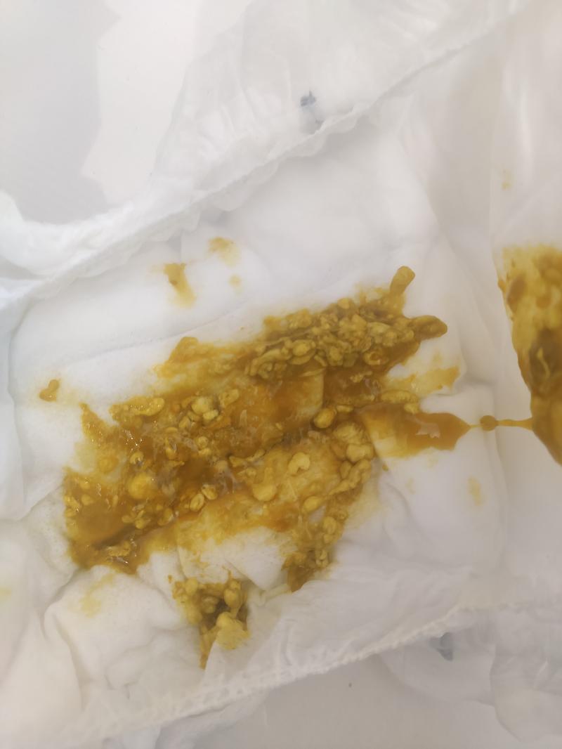 Kolor stolca a zdrowie niemowlaka