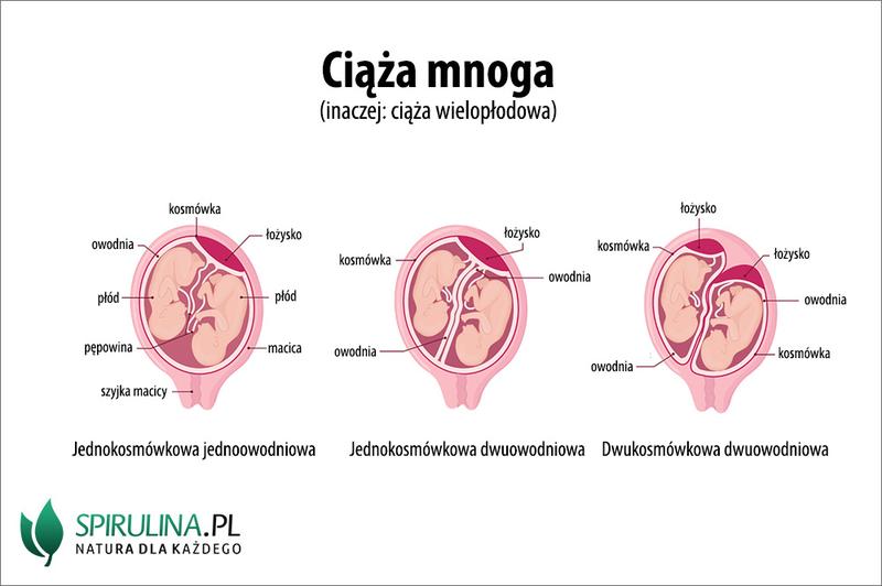 Leki i zabiegi a ciąża bliźniacza