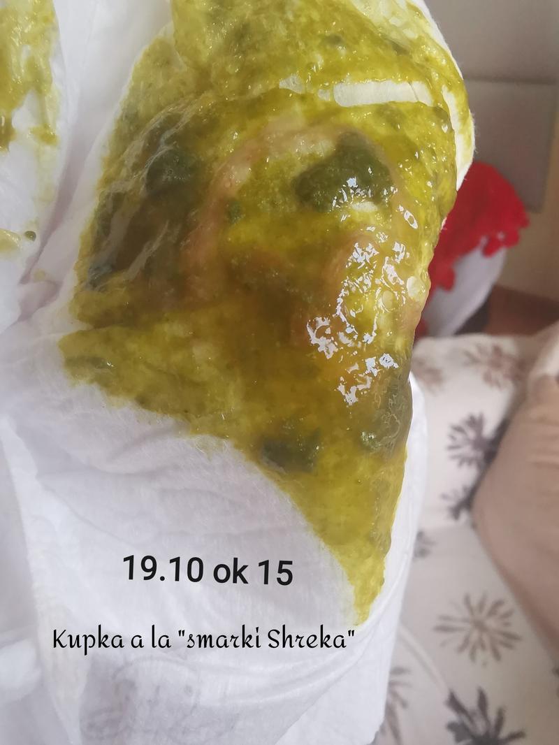 Rozwój układu pokarmowego niemowlęcia