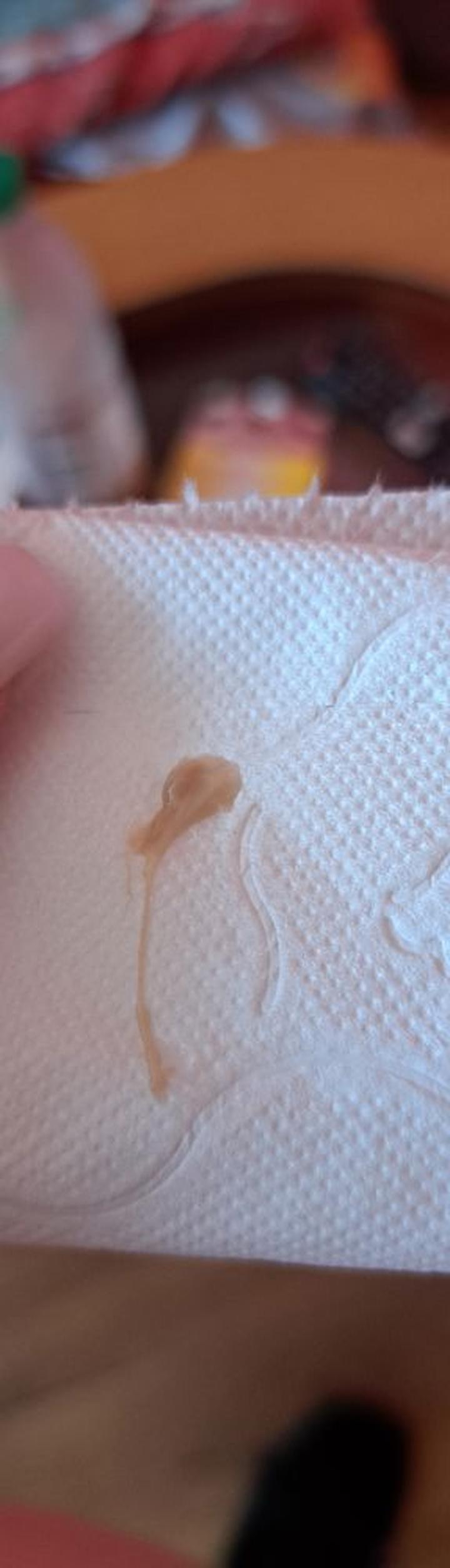 Śluz szyjkowy w ciąży