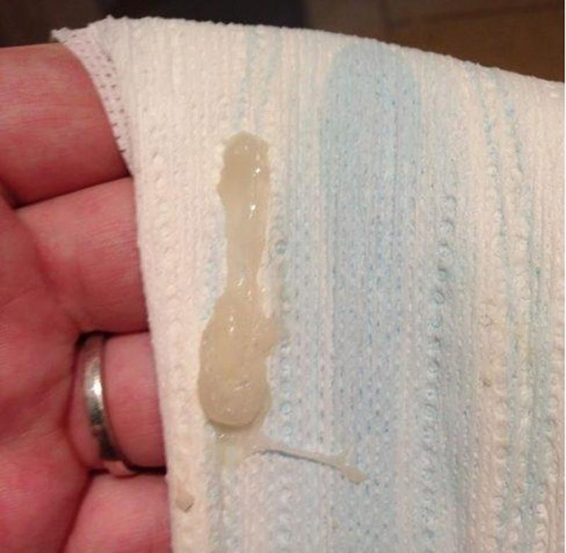 Śluz w pierwszym trymestrze ciąży