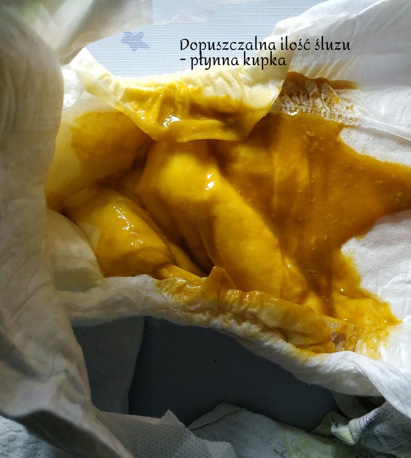 Zmiany koloru kupki sygnały zdrowotne