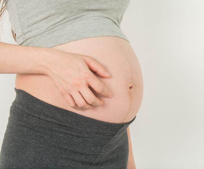 Czy wysypka w ciąży powinna budzić niepokój? Dowiedz się, co warto wiedzieć.