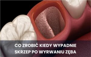 Skrzepy krwi po porodzie – co warto wiedzieć i kiedy się martwić?
