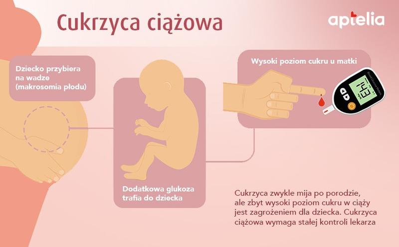 Monitorowanie glukozy w ciąży
