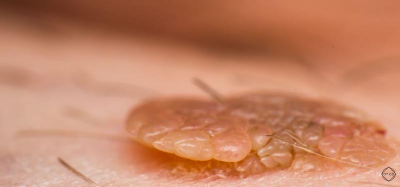 Naturalne sposoby wspierania odporności dzieci