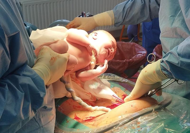 Poród naturalny po cesarskim cięciu