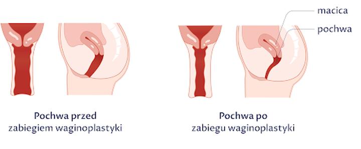 Rekonwalescencja i zdrowie intymne po porodzie