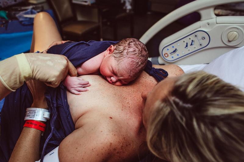 Korzyści i zagrożenia porodu po cesarce