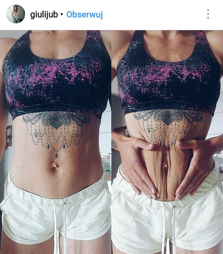 Powrót do formy po ciąży