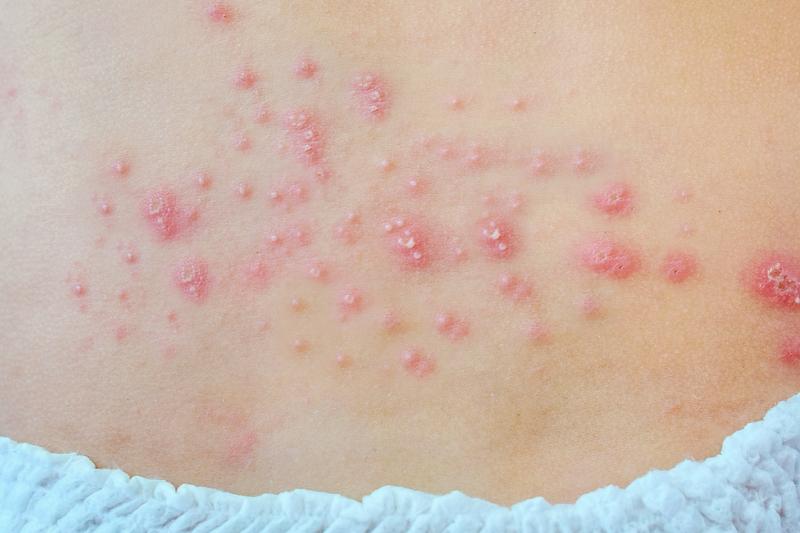 Zagrożenia dla matki i płodu