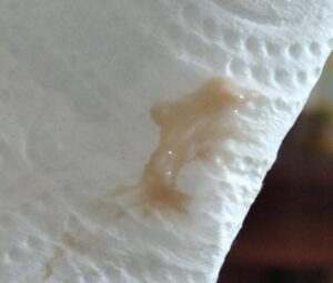 Co oznacza brązowy śluz po terminie porodu? Wskazówki i porady dla przyszłych mam