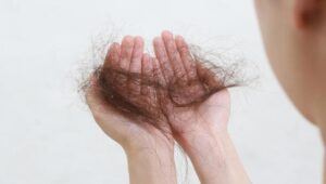 Jak radzić sobie z wypadaniem włosów w czasie karmienia piersią?