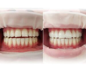 Jak skóra do skóry po porodzie wpływa na bond między mamą a dzieckiem?